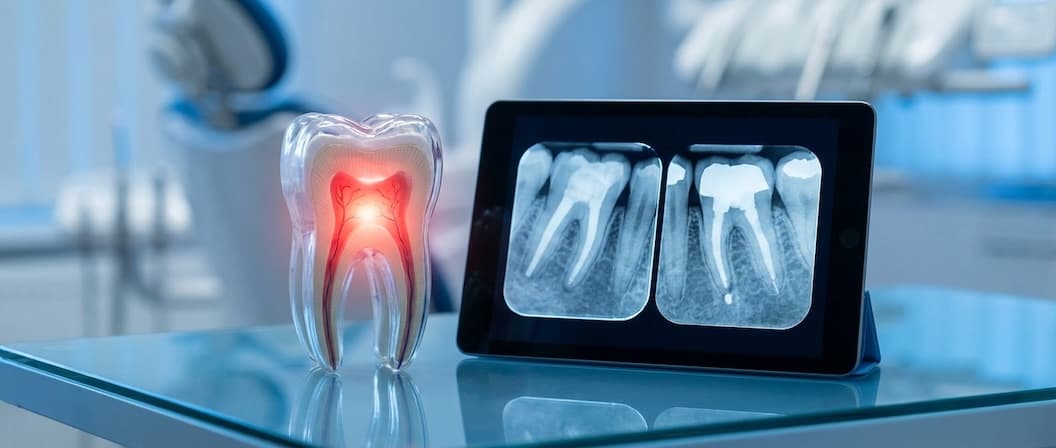Professional Emergency Root Canal procedure at Prime Dental - serving Baldwin Park, El Monte, La Crescenta, and 5 more LA County cities